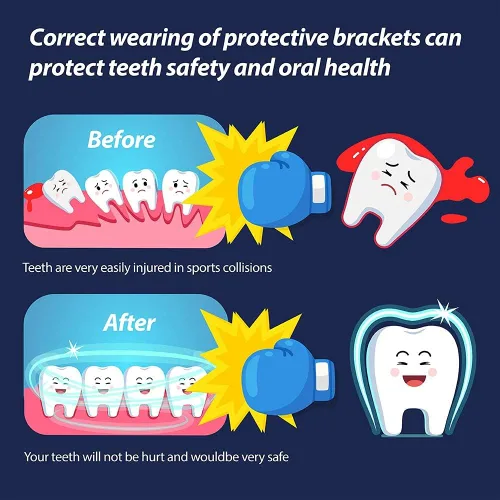 Vista 3 de Youth Mouth Guard Football Sport Mouthguard, Premium Quality No Boiling Required，Suitable for Basketball, Wrestling, Taekwondo, Jujitsu and Karate