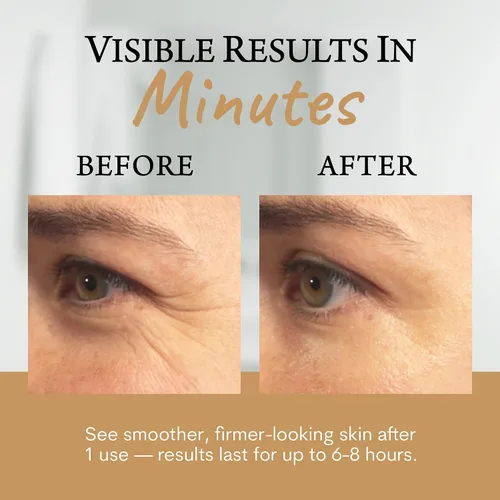 Vista 4 de Biologic MaxiLift - Suero de estiramiento facial instantáneo para mujeres, reafirma y suaviza la piel flácida, líneas finas y arrugas, 0.5 onzas