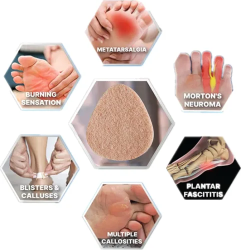 Vista 3 de 20 Pack Metatarsal Pads for Women and Men, Felt Ball of Foot Cushion, Adhesive Forefoot Pads Forefoot Cushion Pads, Foot Pads for Forefoot and Sole