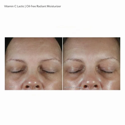 Vista 8 de Dr Dennis Gross VitC+Crema hidratante radiante sin aceite láctico, 1.7 fl oz/1.7 fl oz