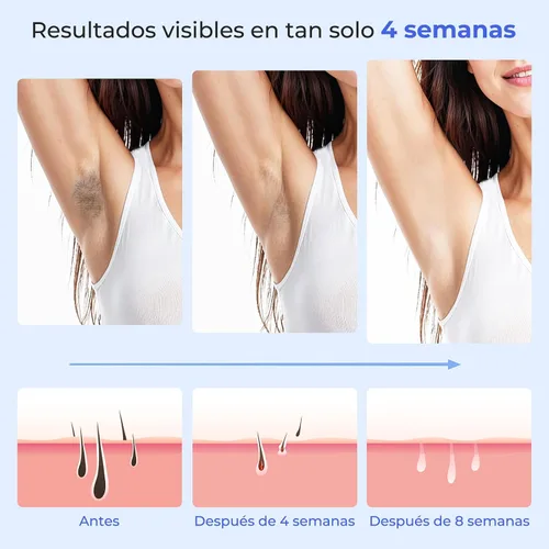 Vista 3 de Depilación láser para mujeres y hombres – Dispositivo de depilación láser ZAIRUZ IPL con enfriamiento de hielo sin dolor a 41.0 °F, removedor