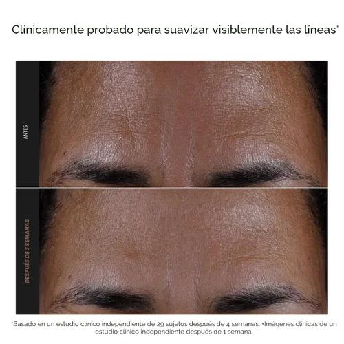 Vista 4 de Paula's Choice SKIN PERFECTING 2% BHA Liquid Exfoliant with Salicylic Acid, Facial Polish for Pores, Wrinkles & Fine Lines, Suitable for
