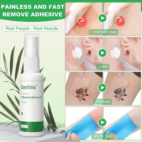 Vista 4 de Spray removedor de adhesivo, removedor de adhesivo médico sin picaduras para la piel, ideal para pacientes con ostomía, eliminación de piel sensible