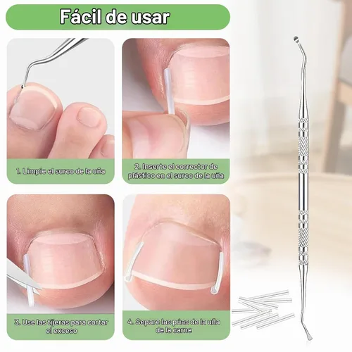 Vista 5 de Juego de corrector de uñas encarnadas con tiras correctoras, kit de herramientas profesionales para uñas de los pies, incluye tiras transpirables