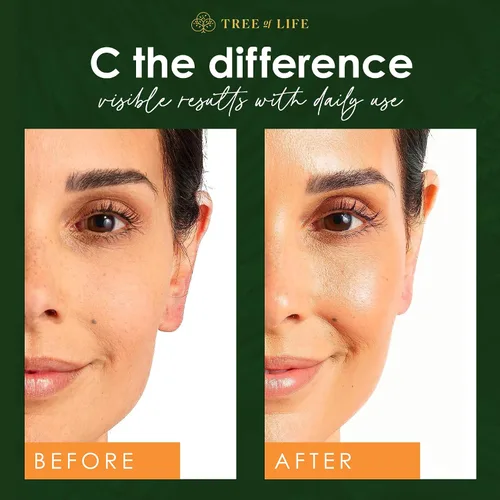 Vista 3 de Tree of Life Beauty Suero facial de vitamina C para piel seca y sensible (1 onza líquida) y cápsulas de suero de vitamina C y retinol