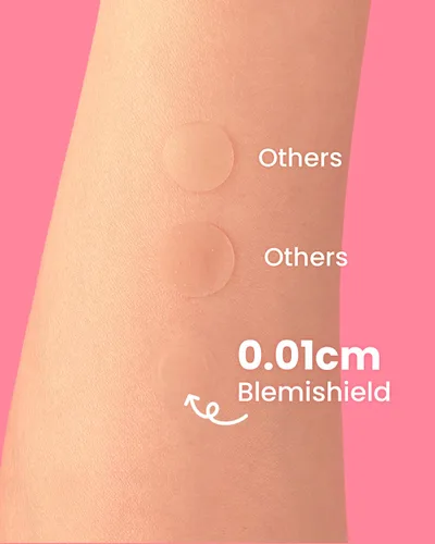 Vista 6 de GLAM UP Parches hidrocoloides para manchas de espinillas – Adhesivos invisibles ultrafinos para cara y piel, fuertes a prueba de agua y adhesivo