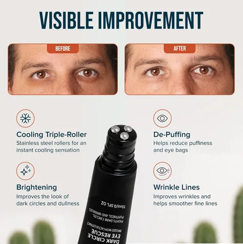 Vista 3 de Cardon Rescate del círculo oscuro para hombres y mujeres Masajeador de ojos con rodillo debajo de los ojos para ojos hinchados, ojeras, bolsas
