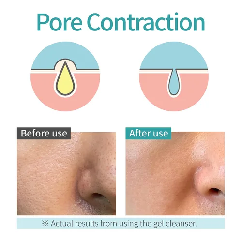 Vista 5 de ] Gel limpiador facial AC-Pixel Limpiador de refinación de poros Piel sensible y grasa Lavado facial coreano para arrugas Limpiador facial