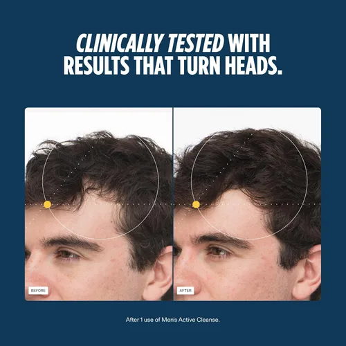 Vista 5 de Nutrafol Champú y acondicionador 2 en 1 para hombres, limpia, hidrata, desobstruye los poros, mejora el volumen y la fuerza del cabello, formulado