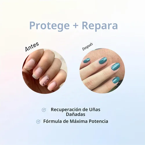 Vista 4 de duri Rejuvacote 1 fortalecedor de uñas, fórmula de efecto máximo, para uñas quebradizas, débiles o posteriores a daños