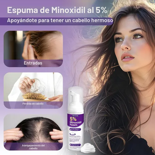 Vista 6 de 5% de espuma de minoxidil para mujer, espuma para el crecimiento del cabello, adecuada para adelgazamiento del cabello, retroceso de la línea