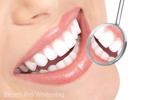 Vista 7 de Dispensadores de jeringas de gel blanqueador de dientes 22% de peróxido de carbamida, 10 jeringas de gel blanqueador de dientes de 0.1 fl oz