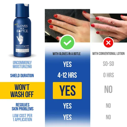 Vista 2 de Loción de Manos Gloves In A Bottle para Enfermeras – Mejor Crema de Manos de Viaje para Manos Secas y Agrietadas, Alivio del Eczema y Psoriasis