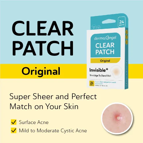 Vista 4 de DERMA ANGEL Parches de acné ultra invisibles para tratamiento del acné quístico, parches para manchas de acné quístico, parches hidrocoloides, uso