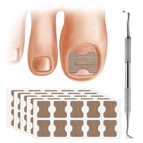 Vista 8 de FERYES Juego de corrector de uñas encarnadas, herramienta profesional de pedicura, 40 tiras alisadoras de uñas encarnadas sin dolor, 50 parches