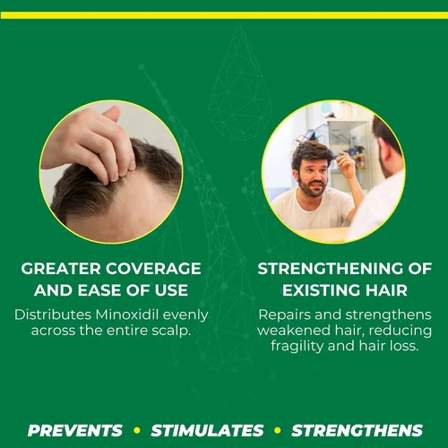 Vista 3 de CrecePelo Minoxidil 2% Crema sin enjuague 12.5 oz - Tratamiento contra la caída del cabello para hombres y mujeres - Fórmula de peinado