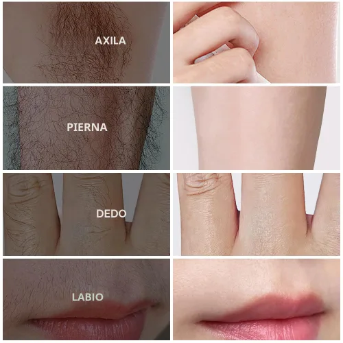 Vista 7 de Crema de depilación PHOFAY para pieles sensibles de hombres y mujeres – Depiladora de acción rápida y suave, recomendada por dermatólogos con aloe