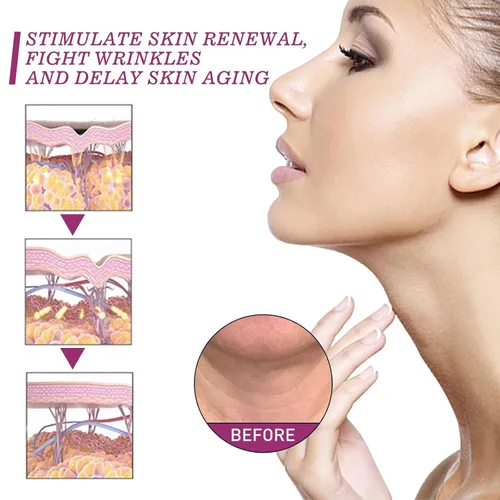 Vista 5 de España NECKPON Crema de cuello de colágeno hidrolizado, crema reafirmante para el cuello que aprieta la piel flácida antienvejecimiento crema