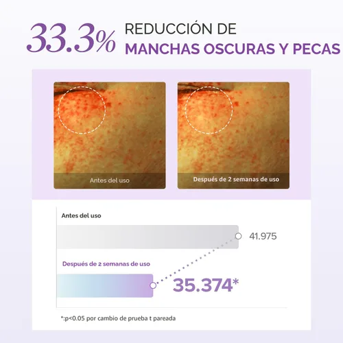 Vista 4 de Mary&May Set especial de crema para ojos de glutatión - Potente antioxidante, reduce las ojeras en los ojos, mejora el tono desigual de la piel