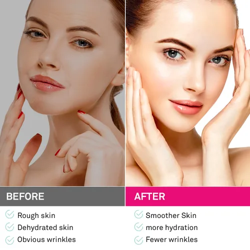 Vista 4 de Parches faciales y antiarrugas para la frente: tratamiento de arrugas faciales para la frente, línea de sonrisa, debajo de los ojos- parches