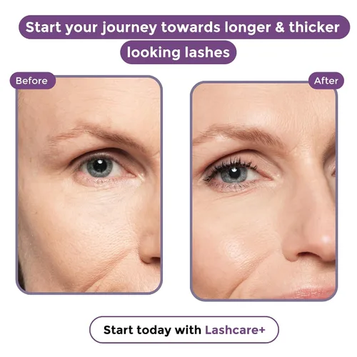 Vista 7 de LashCare+ Suero para mejorar las pestañas para mujeres maduras, pestañas más largas y gruesas en 12 semanas, para ojos sensibles, crecimiento
