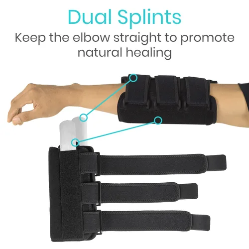 Vista 4 de Vive Férula de codo para tendinitis, túnel cubital, soporte para dormir, codo de tenista, 2 férulas extraíbles que estabilizan las articulaciones