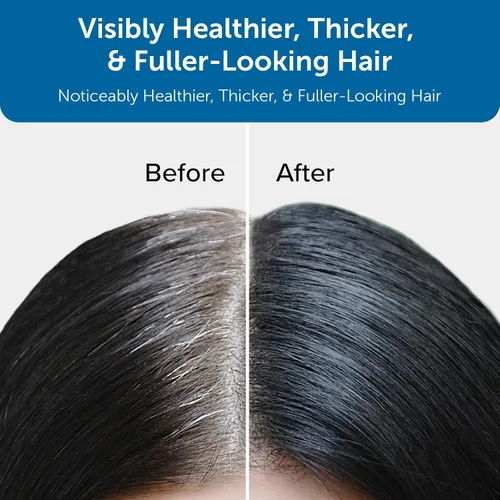 Vista 5 de Champú y acondicionador premium para crecimiento del cabello