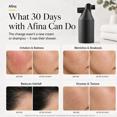Vista 5 de Filtro de ducha Afina para agua dura - Elimina el 99% del cloro, sustancias nocivas y metales pesados - Mejora tu piel y cabello (Negro) Reduce