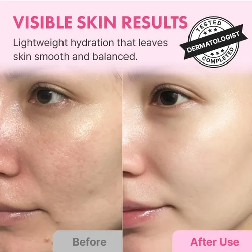 Vista 2 de Hanskin Hyaluron Skin Essence Toner – Tónico hidratante coreano para piel de cristal, ácido hialurónico y colágeno, astringente hidratante ligero