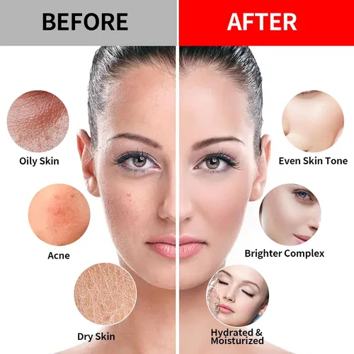 Vista 5 de Máscara de gelatina de vampiro + ácido hialurónico, cuidado de la piel facial, máscara de hidrojelia, máscara facial para tratamientos faciales