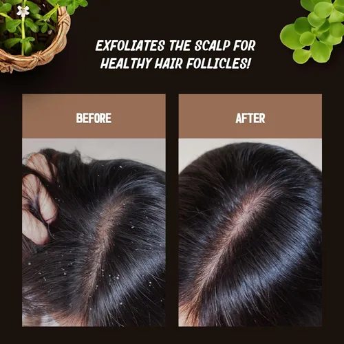 Vista 4 de Brahmi - Exfoliante y limpiador para el cuero cabelludo para hombres y mujeres, exfoliación profunda y limpieza, perfecto para el cuidado