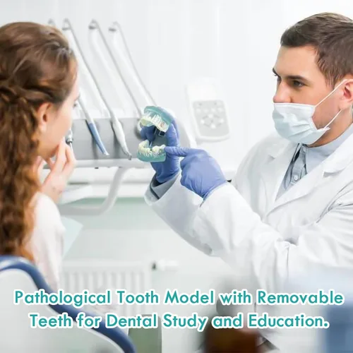 Vista 7 de Modelo de dientes de implante dental transparente - Modelo de dientes de enfermedad transparente Modelo de dientes patológicos con dientes