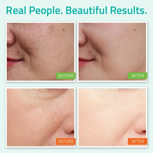 Vista 3 de YEOUTH Set de cuidado de la piel: suero de ácido hialurónico con vitamina C, tónico facial, hidratante facial, kit de cuidado de la piel