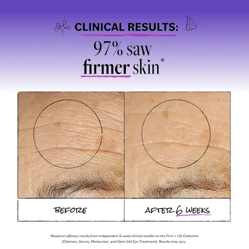 Vista 3 de DERMA E Ultra Lift DMAE suero concentrado – Suero reafirmante de la piel totalmente natural – Suero hidratante con péptidos de cobre y resveratrol