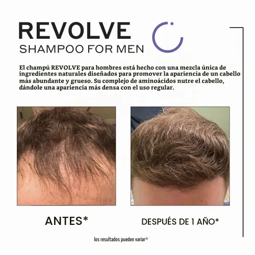 Vista 2 de Zenagen Revolve - Tratamiento de pérdida de cabello para hombres