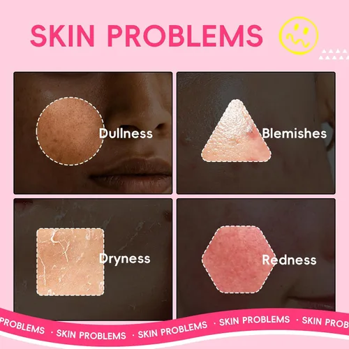 Vista 5 de QUIYUM - Juego de cuidado de la piel de sandía y niacinamida, kit facial brillante de 3 piezas para adolescentes 3-in-1 Daily Routine: Cleanser