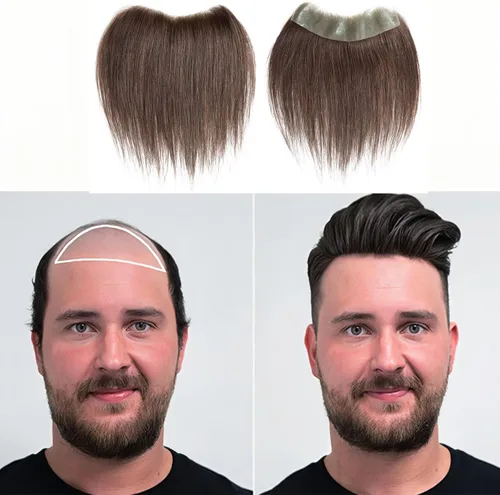 Vista 14 de Extensión frontal de cabello rubio claro para hombres, extensión de cabello lacio con pérdida de línea de cabello humano con cinta adhesiva