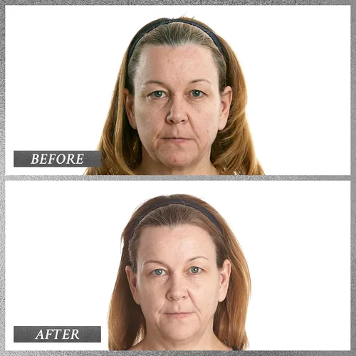 Vista 3 de PRAI Beauty Platinum Firm & Lift Crema de noche, antienvejecimiento e hidratante hidratante para mujeres, crema de noche hidratante y revitalizante
