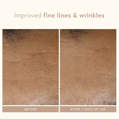 Vista 4 de SHANI DARDEN SKIN CARE - Varita para esculpir el rostro, dispositivo de reafirmación y apriete del cuello, dispositivo de ondas de sonido