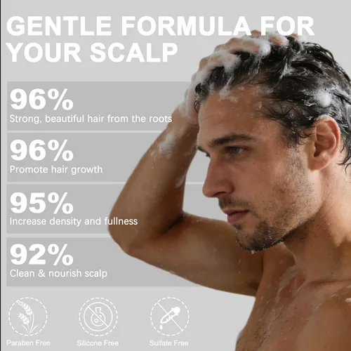 Vista 3 de Champú, champú de cebolla para el crecimiento del cabello, con aceite de romero, cebolla roja, canela, previene eficazmente la pérdida de cabello