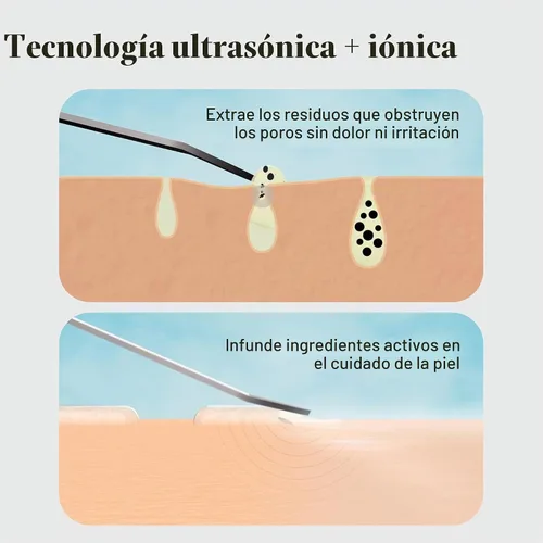 Vista 9 de DERMAFLASH DERMAPORE+ Dispositivo de cuidado de la piel, extractor ultrasónico de poros 2 en 1 e infusor para el cuidado de la piel, rubor