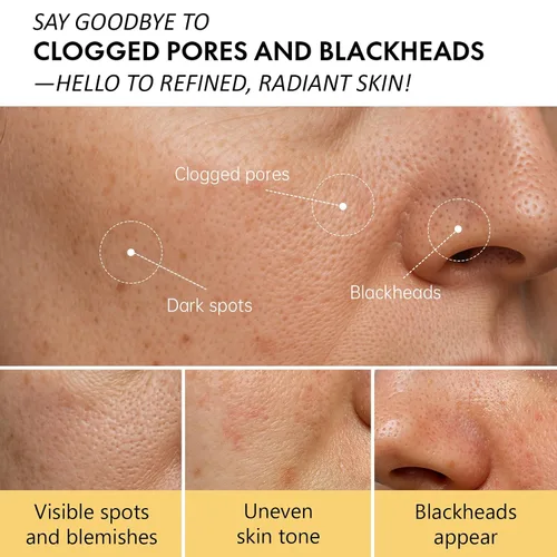 Vista 5 de Máscara facial de arcilla calentadora para limpieza profunda de poros – Máscara de barro autocalentable para cara, tratamiento purificador