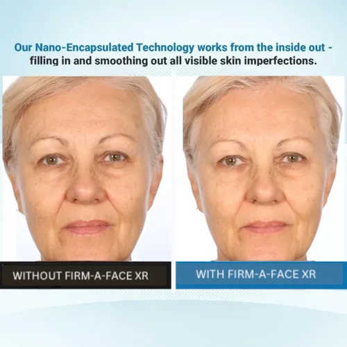 Vista 6 de Serious Skincare - Instant FIRM A FACE XR - Tensor facial temporal - Firme invisiblemente, levanta y suaviza el aspecto de líneas finas, arrugas