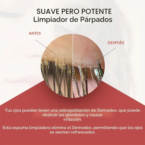 Vista 4 de Zocular ZocuFoam Limpiador Espumoso para Párpados – Espuma Limpiadora Suave con pH Equilibrado – 25 mL