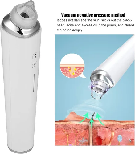 Vista 3 de Aspiradora eliminadora de puntos negros, limpiador eléctrico de poros facial 2021, herramienta extractor de acné recargable por USB, kit