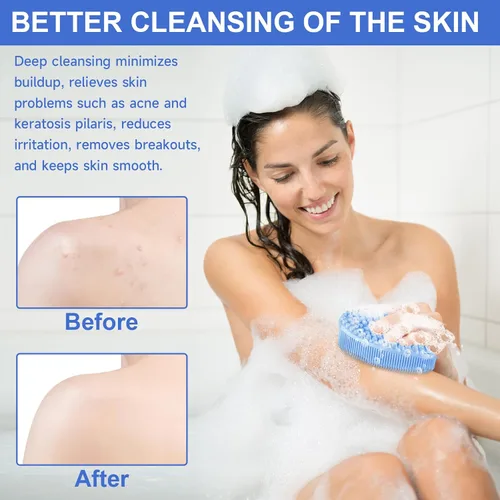 Vista 4 de Metene cepillo exfoliante corporal de silicona con asa, cepillo corporal para hombres y mujeres, esponja de silicona para la ducha, silicona suave