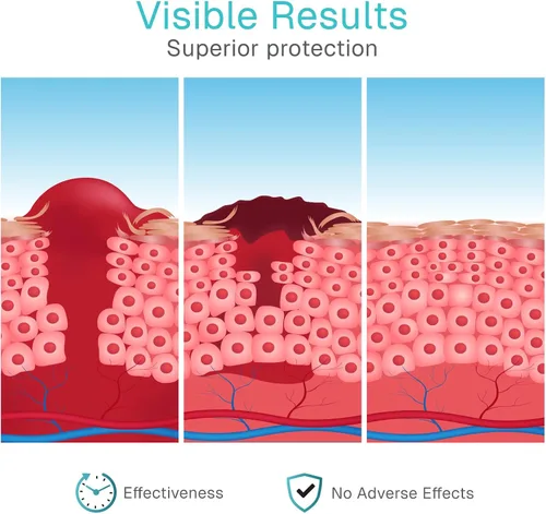 Vista 8 de ViveCare - Apósito de hidrogel para heridas (tubo de 3 onzas), gel curativo de primeros auxilios para quemaduras, úlceras diabéticas, cortes