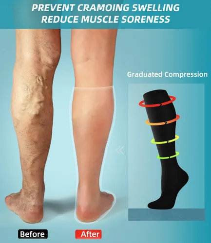 Vista 3 de FuelMeFoot Calcetines de compresión para mujeres y hombres, para circulación, con soporte graduado, hasta la rodilla, para enfermeras, viajes