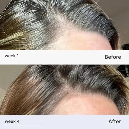 Vista 3 de Better Not Younger Suero fortificante para el cabello y el cuero cabelludo para adelgazar y envejecer el cabello, suero para cabello más fuerte
