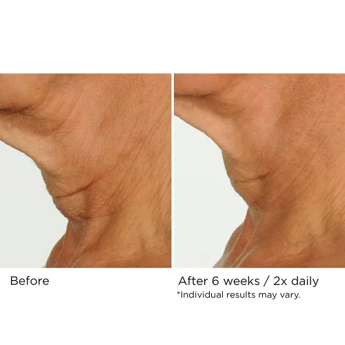 Vista 8 de NassifMD Deco-Lift Neck & Decollete Firming & Lifting Complex